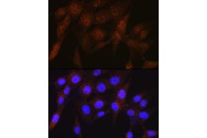 Immunofluorescence analysis of NIH-3T3 cells using PSMD4 Rabbit mAb (ABIN1681255, ABIN3017957, ABIN3017958 and ABIN7101547) at dilution of 1:100 (40x lens). (PSMD4/ASF 抗体)