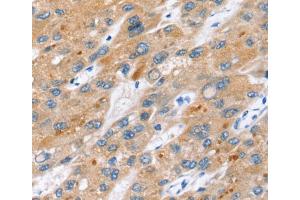 Immunohistochemistry (IHC) image for anti-Endogenous Retrovirus Group W, Member 1 (ERVW-1) antibody (ABIN2427359) (ERVW-1 抗体)