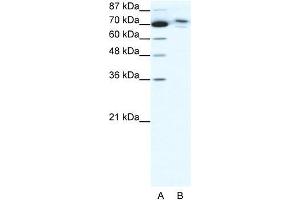 Human HepG2; WB Suggested Anti-C14ORF101 Antibody Titration: 0. (C14orf101 抗体  (N-Term))