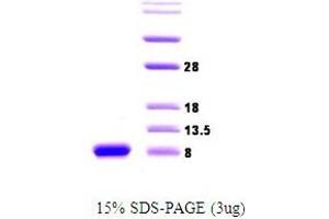 Figure annotation denotes ug of protein loaded and % gel used. (alpha Synuclein 195 (active) 蛋白)