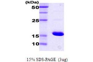 SDS-PAGE (SDS) image for DnaK (AA 385-546) protein (ABIN666828) (DnaK (AA 385-546) 蛋白)