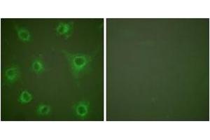 Immunofluorescence analysis of COS7 cells, using Collagen II Antibody. (COL2 抗体  (AA 101-150))