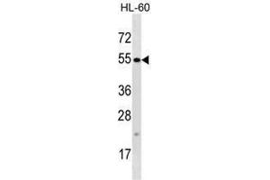 TTC34 Antibody (C-term) western blot analysis in HL-60 cell line lysates (35 µg/lane). (TTC34 抗体  (C-Term))