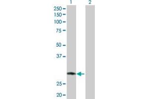 Western Blot analysis of RNF144B expression in transfected 293T cell line by RNF144B MaxPab polyclonal antibody. (RNF144B 抗体  (AA 1-302))