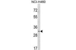 Western Blotting (WB) image for anti-SNAI antibody (ABIN2912021) (SNAI 抗体)