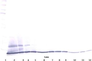 Western Blot (Reduced) using ESkine / CCL27 antibody (CCL27 抗体)