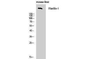 Western Blotting (WB) image for anti-Fibrillin 1 (FBN1) (C-Term) antibody (ABIN3184601) (Fibrillin 1 抗体  (C-Term))