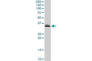 RDHE2 MaxPab rabbit polyclonal antibody. (SDR16C5 抗体  (AA 1-309))