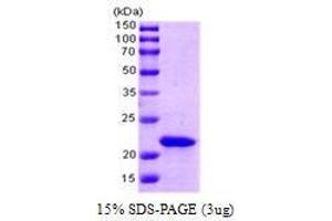 Figure annotation denotes ug of protein loaded and % gel used. (SlyD (AA 1-196) (Active) 蛋白)