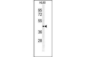 Image no. 1 for anti-Sulfotransferase Family, Cytosolic, 2B, Member 1 (SULT2B1) (N-Term) antibody (ABIN357809) (SULT2B1 抗体  (N-Term))