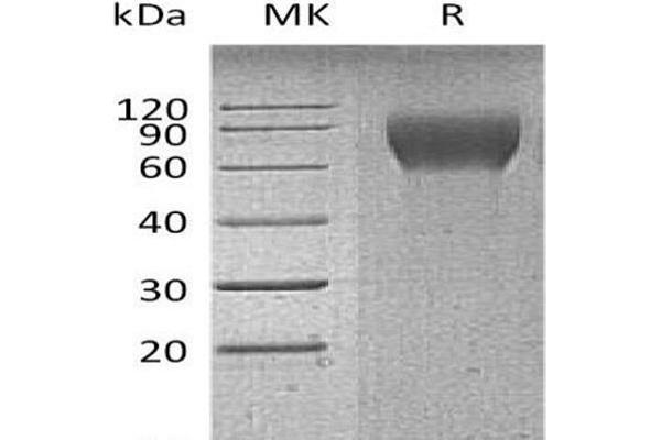 CD6 Protein (CD6) (His tag)