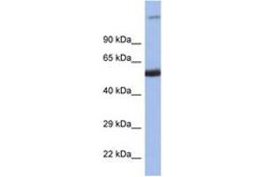Image no. 1 for anti-Interferon Regulatory Factor 8 (IRF8) (C-Term) antibody (ABIN6747508) (IRF8 抗体  (C-Term))