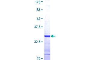 Image no. 1 for Gephyrin (GPHN) (AA 677-769) protein (GST tag) (ABIN1355540) (Gephyrin Protein (GPHN) (AA 677-769) (GST tag))