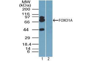 Image no. 1 for anti-Forkhead Box O1 (FOXO1) (AA 250-300) antibody (ABIN960178) (FOXO1 抗体  (AA 250-300))