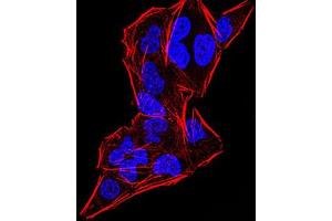 Immunocytochemistry (ICC) image for anti-DEAD (Asp-Glu-Ala-Asp) Box Polypeptide 20 (DDX20) (AA 725-824) antibody (ABIN5899146) (DDX20 抗体  (AA 725-824))