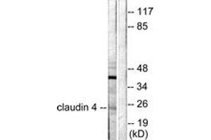 Western blot analysis of extracts from HeLa cells, using Claudin 4 Antibody. (Claudin 4 抗体  (AA 160-209))