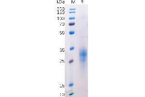 Human BTLA Protein, His Tag on SDS-PAGE under reducing condition. (BTLA Protein (AA 31-150) (His tag))