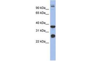 Image no. 1 for anti-Biglycan (BGN) (AA 215-264) antibody (ABIN6744047) (Biglycan 抗体  (AA 215-264))