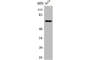 Western Blot analysis of HeLa cells using Phospho-Paxillin (Y31) Polyclonal Antibody (Paxillin 抗体  (pTyr31))