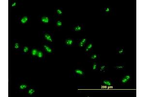 Immunofluorescence of purified MaxPab antibody to LYAR on HeLa cell. (LYAR 抗体  (AA 1-379))
