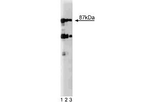 Western blot analysis of Dystrobrevin on rat brain lysate. (Dystrobrevin (AA 249-403) 抗体)