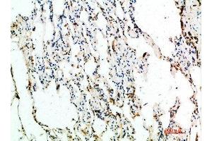 Immunohistochemical analysis of paraffin-embedded human-lung, antibody was diluted at 1:200 (ASCL1 抗体  (AA 190-236))