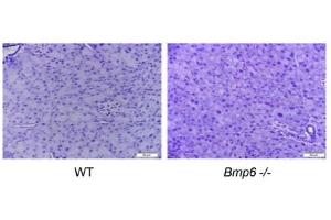 Young Bmp6‑/‑ mice exhibit iron overload in the exocrine pancreas with no histological changes. (Macrophages (pan) 抗体)