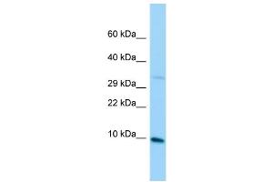 Host: Rabbit Target Name: MRPL36 Sample Type: Jurkat Whole Cell lysates Antibody Dilution: 1. (MRPL36 抗体  (C-Term))