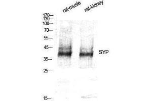 Western Blotting (WB) image for anti-Synaptophysin (SYP) (Internal Region) antibody (ABIN3187137) (Synaptophysin 抗体  (Internal Region))