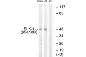 Western Blotting (WB) image for anti-ELK1, Member of ETS Oncogene Family (ELK1) (pSer389) antibody (ABIN2888404) (ELK1 抗体  (pSer389))