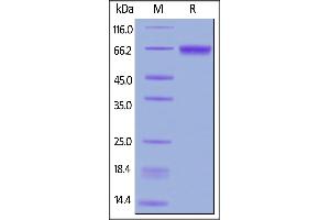 Human CD229, His Tag on  under reducing (R) condition. (LY9 Protein (AA 48-454) (His tag))