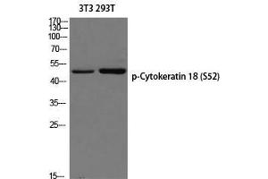 Western Blot (WB) analysis of 3T3 293T using p-Cytokeratin 18 (S52) antibody. (Cytokeratin 18 抗体  (pSer52))