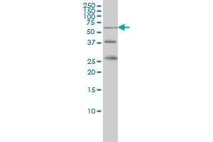 RIOK3 monoclonal antibody (M02A), clone 3G11 Western Blot analysis of RIOK3 expression in K-562 . (RIOK3 抗体  (AA 411-516))
