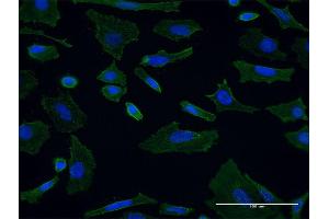 Immunofluorescence of monoclonal antibody to SH3GL1 on HeLa cell. (SH3GL1 抗体  (AA 1-369))