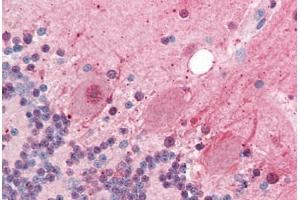 Human Brain, Cerebellum (formalin-fixed, paraffin-embedded) stained with SIRT2 antibody ABIN461916 at 5 ug/ml followed by biotinylated goat anti-rabbit IgG secondary antibody ABIN481713, alkaline phosphatase-streptavidin and chromogen. (SIRT2 抗体  (N-Term))