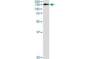 Immunoprecipitation (IP) image for anti-WW Domain Containing E3 Ubiquitin Protein Ligase 1 (WWP1) (AA 152-260) antibody (ABIN564794)