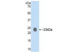 Detection of Recombinant NEP, Human using Polyclonal Antibody to Neprilysin (CD10) (MME 抗体  (AA 565-750))