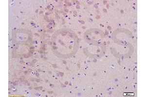 Formalin-fixed and paraffin embedded rat brain labeled with Anti-PHOSPHO-LLGL1 + LLGL2(SER650+SER654) Antibody, Unconjugated (ABIN761981) at 1:200 followed by conjugation to the secondary antibody and DAB staining (LLGL1 + LLGL2 (pSer650), (pSer654) 抗体)