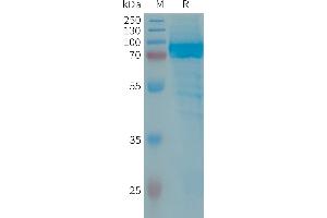 Human IL13RA2 Protein, hFc Tag on SDS-PAGE under reducing condition. (IL13RA2 Protein (AA 27-340) (Fc Tag))