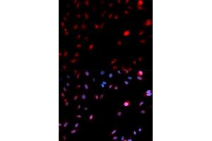 Immunofluorescence (IF) image for anti-Cyclin-Dependent Kinase 1 (CDK1) (pTyr15) antibody (ABIN1870049) (CDK1 抗体  (pTyr15))