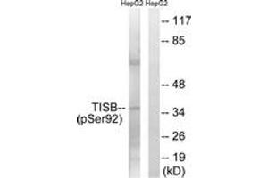 Western blot analysis of extracts from HepG2 cells, using TISB (Phospho-Ser92) Antibody. (ZFP36L1 抗体  (pSer92))