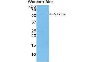 Western Blotting (WB) image for anti-C2 Calcium-Dependent Domain Containing 3 (C2CD3) (AA 1432-1647) antibody (ABIN1858188) (C2CD3 抗体  (AA 1432-1647))