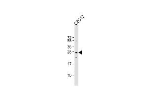 Anti-Mouse p27Kip1 Antibody (C-term ) at 1:1000 dilution + C2C12 whole cell lysate Lysates/proteins at 20 μg per lane. (CDKN1B 抗体  (C-Term))