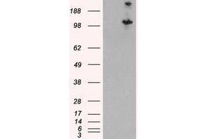 Image no. 2 for anti-Tuberous Sclerosis 1 (TSC1) (C-Term), (Isoform 1) antibody (ABIN374676) (TSC1 抗体  (C-Term, Isoform 1))