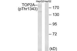Western blot analysis of extracts from HepG2 cells treated with Ca2+ using TOP2A (Phospho-Thr1343) Antibody. (Topoisomerase II alpha 抗体  (pThr1343))