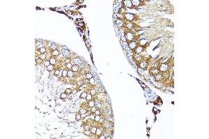 Immunohistochemistry of paraffin-embedded rat testis using TST Rabbit pAb  at dilution of 1:200 (40x lens). (TST 抗体  (AA 1-297))