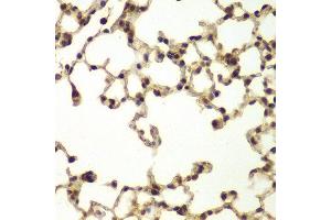 Immunohistochemistry of paraffin-embedded mouse lung using ERCC3 antibody at dilution of 1:200 (400x lens). (ERCC3 抗体)