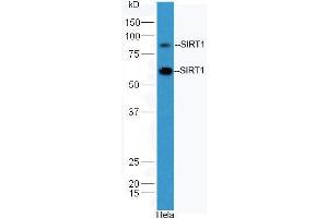 Western Blotting (WB) image for anti-Sirtuin 1 (SIRT1) (AA 101-200) antibody (ABIN729853)