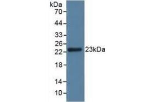 Detection of GPX3 in Rat Kidney Tissue using Polyclonal Antibody to Glutathione Peroxidase 3, Plasma (GPX3) (GPX3 抗体  (AA 3-72))