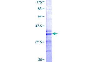 Image no. 1 for Ficolin (Collagen/fibrinogen Domain Containing) 1 (FCN1) (AA 201-300) protein (GST tag) (ABIN1353910) (FCN1 Protein (AA 201-300) (GST tag))